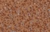ACCZENT MINERAL 100012